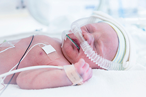 Patologías respiratorias del recién nacido